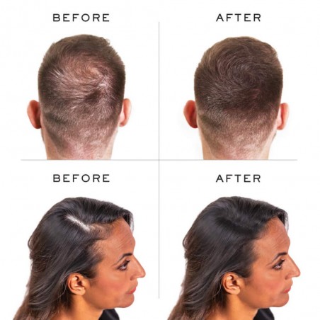 NANOFIBRES NANOGEN DARK BROWN 15G